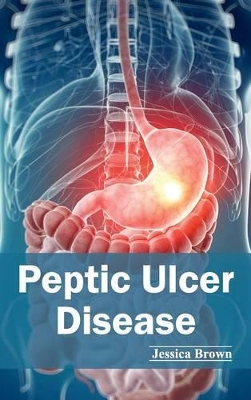 Peptic Ulcer Disease book