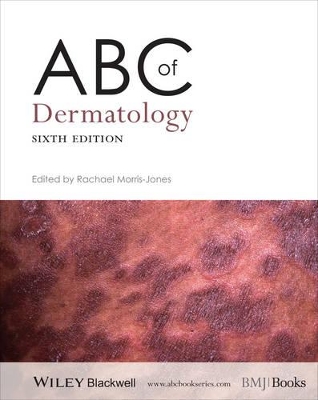 ABC of Dermatology 6E by Rachael Morris-Jones