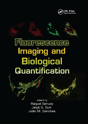 Fluorescence Imaging and Biological Quantification by Raquel Seruca