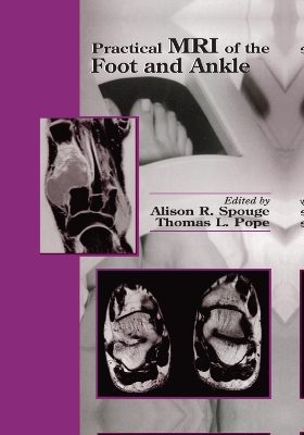 Practical MRI of the Foot and Ankle book