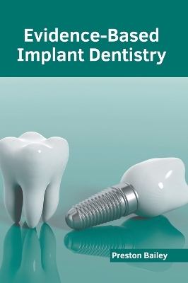 Evidence-Based Implant Dentistry book