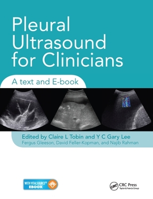 Pleural Ultrasound for Clinicians: A Text and E-book book