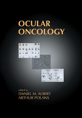 Ocular Oncology by Daniel M. Albert