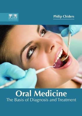 Oral Medicine: The Basis of Diagnosis and Treatment book