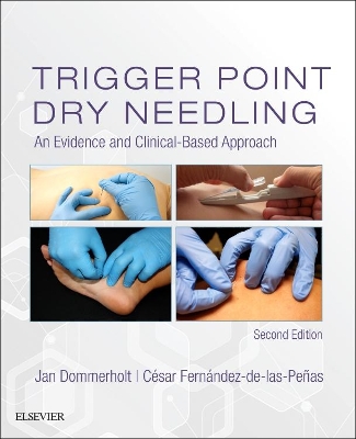 Trigger Point Dry Needling by Jan Dommerholt
