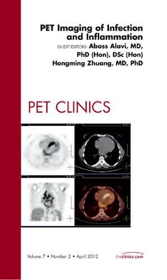 PET Imaging of Infection and Inflammation, An Issue of PET Clinics book