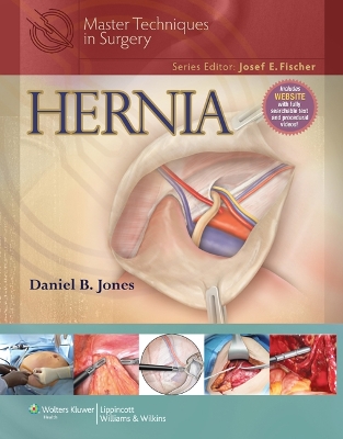 Master Techniques in Surgery: Hernia book