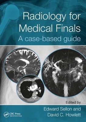 Radiology for Medical Finals book