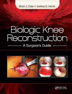 Biologic Knee Reconstruction book