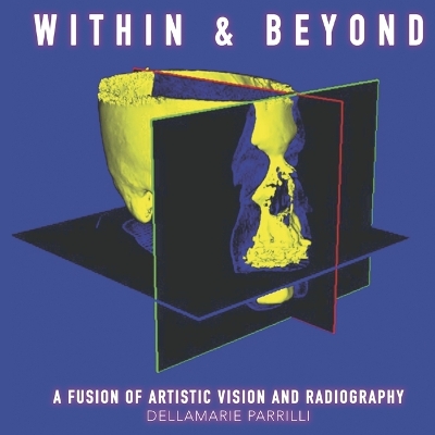 Within & Beyond: A Fusion of Artistic Vision and Radiography book