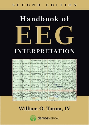 Handbook of EEG Interpretation book