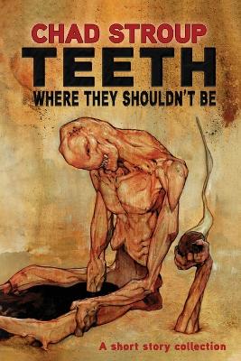 Teeth Where They Shouldn't Be by Chad Stroup