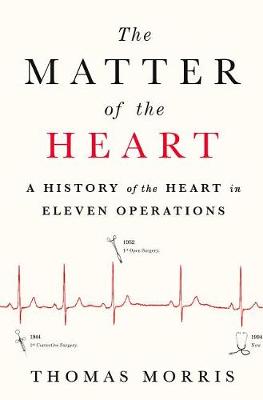 The Matter of the Heart by Thomas Morris