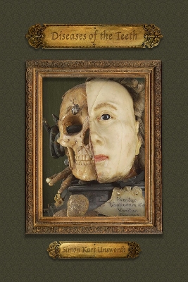 Diseases of the Teeth book