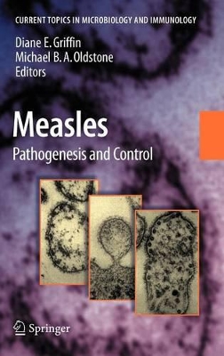 Measles by Diane E. Griffin