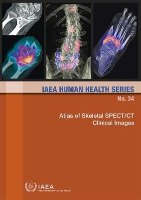 Atlas of Skeletal SPECT/CT Clinical Images book