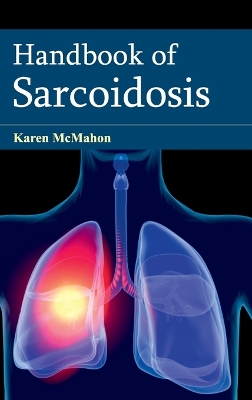 Handbook of Sarcoidosis book