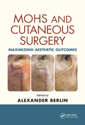 Mohs and Cutaneous Surgery: Maximizing Aesthetic Outcomes by Alexander Berlin