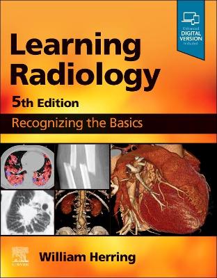Learning Radiology: Recognizing the Basics book