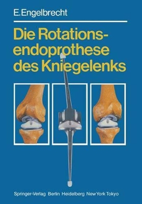 Die Rotationsendoprothese Des Kniegelenks by H. W. Buchholz