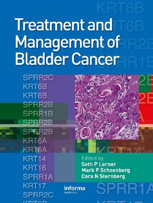 Treatment and Management of Bladder Cancer by Seth P. Lerner