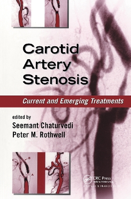 Carotid Artery Stenosis by Seemant Chaturvedi