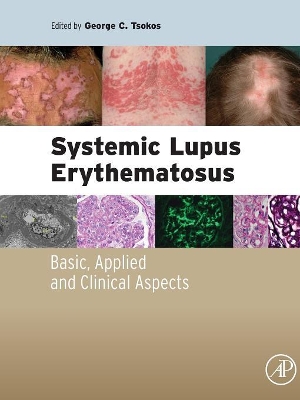 Systemic Lupus Erythematosus by George C. Tsokos