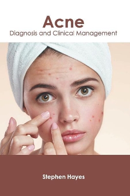 Acne: Diagnosis and Clinical Management book