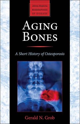 Aging Bones book