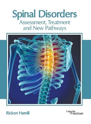 Spinal Disorders: Assessment, Treatment and New Pathways book