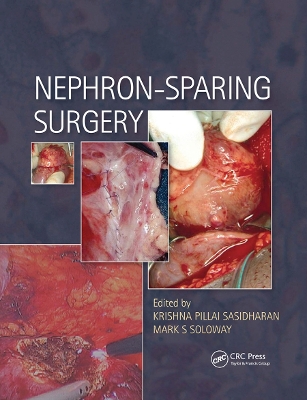 Nephron-Sparing Surgery book