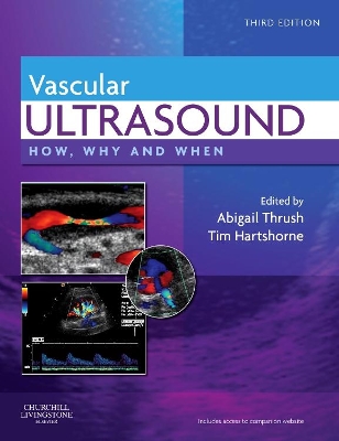 Vascular Ultrasound by Abigail Thrush