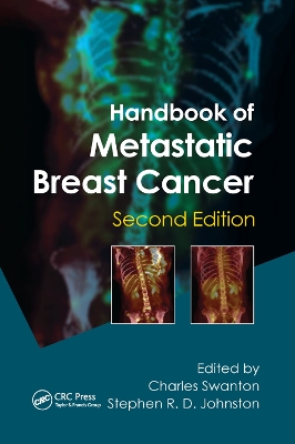 Handbook of Metastatic Breast Cancer by Stephen R D Johnston
