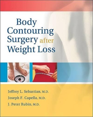 Body Contouring Surgery After Weight Loss book