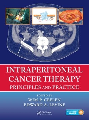 Intraperitoneal Cancer Therapy: Principles and Practice book