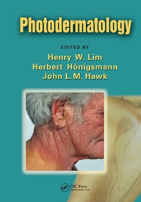 Photodermatology by Henry W. Lim