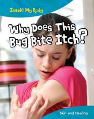 Why does this Bite Itch? book