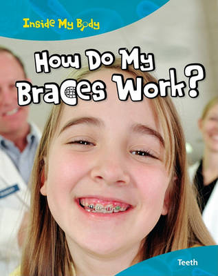 How Do My Braces Work? by Steve Parker