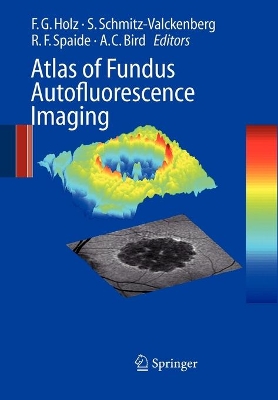 Atlas of Fundus Autofluorescence Imaging by Frank G. Holz