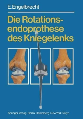 Die Rotationsendoprothese des Kniegelenks book