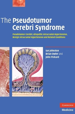 Pseudotumor Cerebri Syndrome book