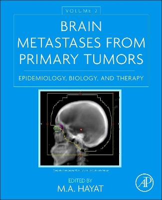 Brain Metastases from Primary Tumors, Volume 2 by M. A. Hayat