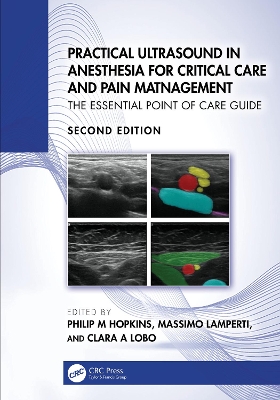 Practical Ultrasound in Anesthesia for Critical Care and Pain Management: The Essential Point of Care Guide by Philip M Hopkins