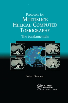 Protocols for Multislice Helical Computed Tomography: The Fundamentals by Dawson Peter