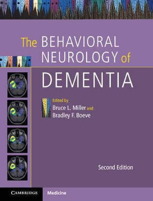 Behavioral Neurology of Dementia book