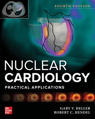 Nuclear Cardiology: Practical Applications, Fourth Edition book