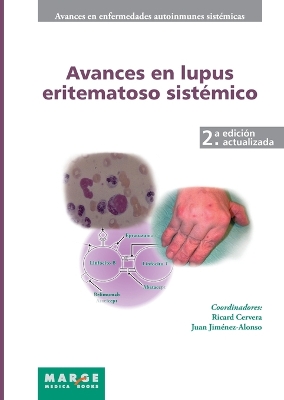 Avances en lupus eritematoso sistémico book