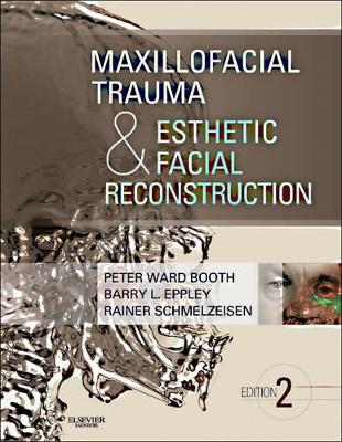 Maxillofacial Trauma and Esthetic Facial Reconstruction book