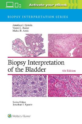 Biopsy Interpretation of the Bladder: Print + eBook with Multimedia book