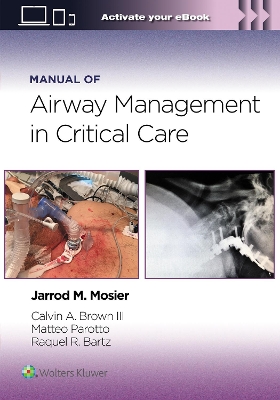 Manual of Airway Management in Critical Care: Print + eBook with Multimedia book